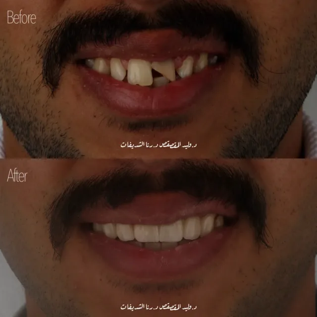 Alwaleed Dental Care 2