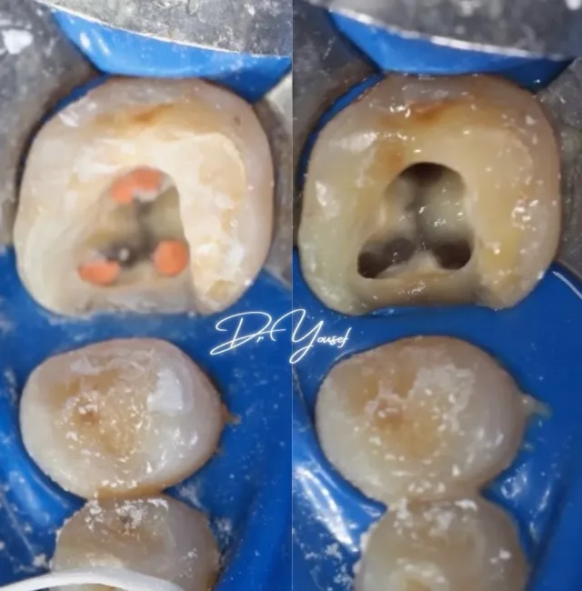 Dr Yousef Alramahi Dental Clinic