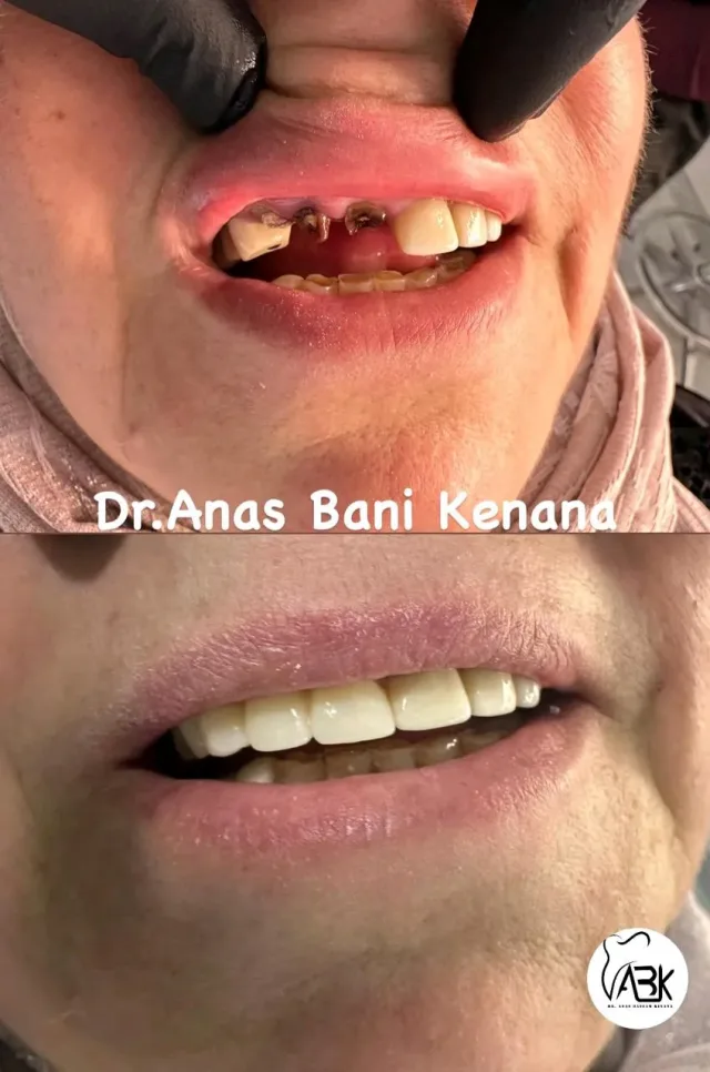الدكتور أنس بسام بني كنانة (طبيب أسنان) 7