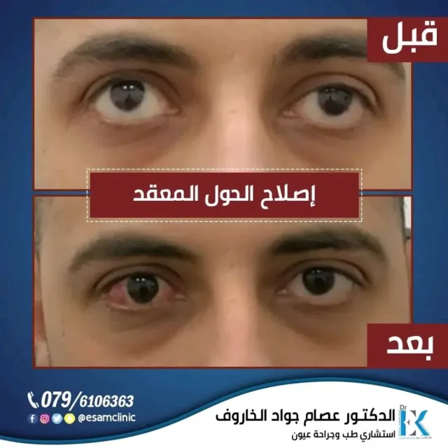 عيادة د.عصام الخاروف لطب وجراحة العيون 9