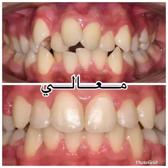 Maali Dental and orthodontic Center 4
