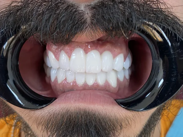 Dr Mohammed Abusbeit Dental clinic 5