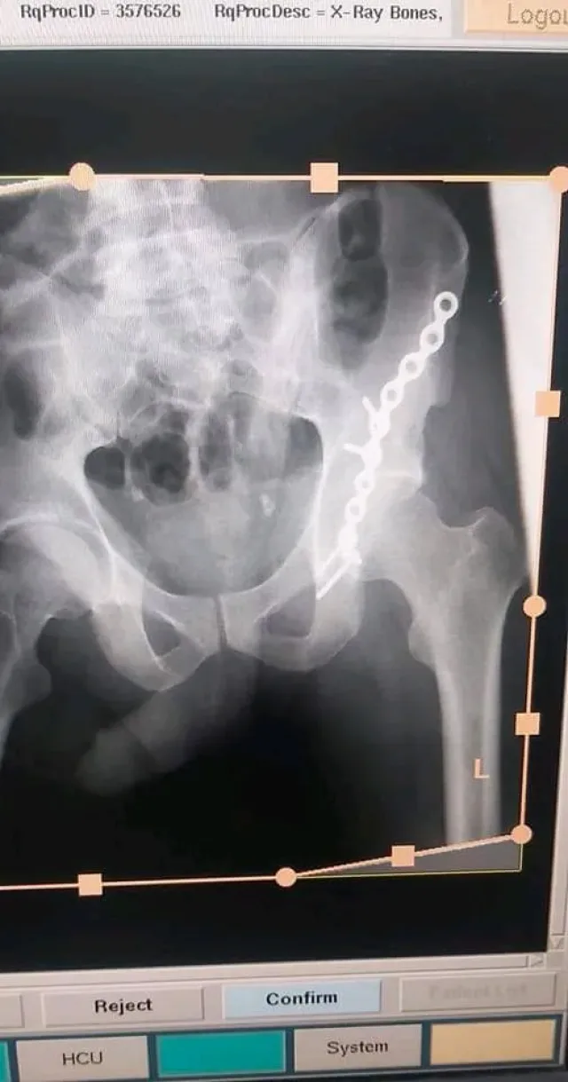 أجمل قوام للعلاج الطبيعي