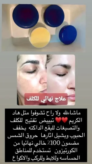 منتجات وخلطات طبيعية