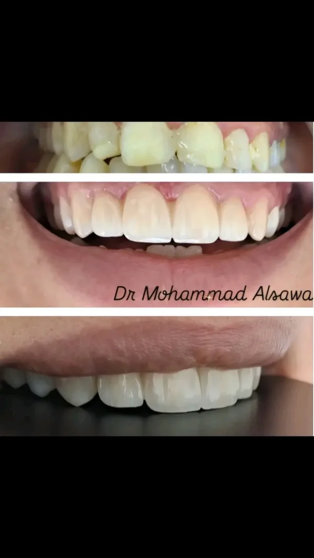 عيادة الدكتور محمد صايل الصوا طب و جراحة الفم والاسنان 6
