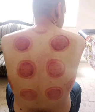 حجامة بأنواعها كايروبرايتيك شياتسو مصل النحل رقية شرعية 3