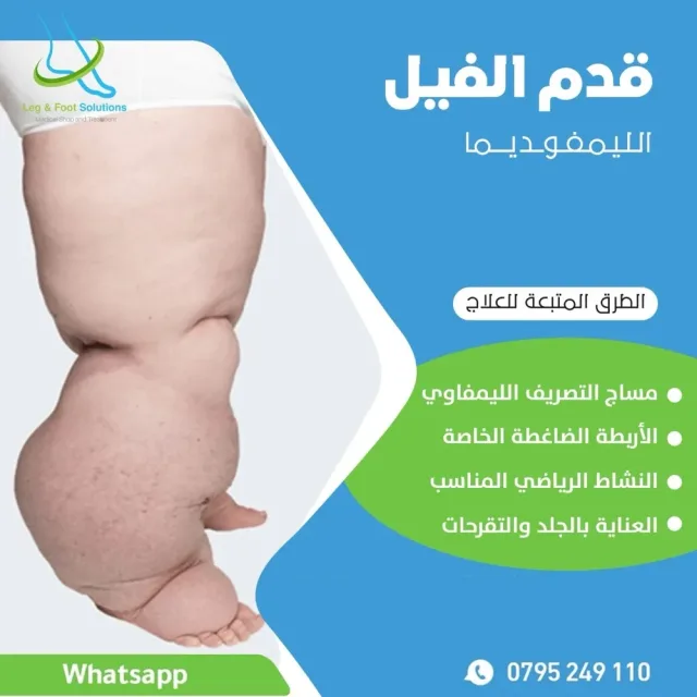 Leg and foot solutions