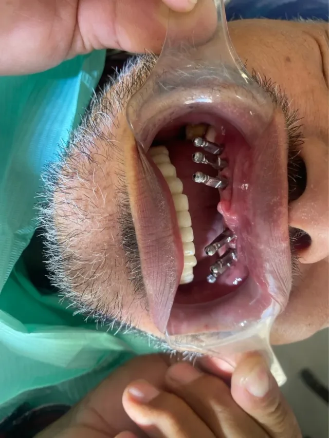 عيادات الصفدي والمومني لطب وزراعة وتقويم الاسنان 9