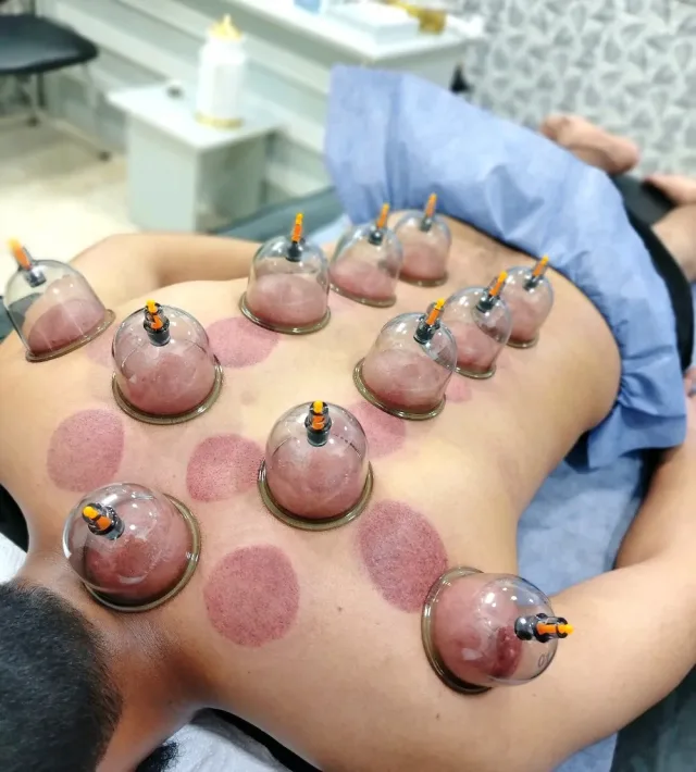 شرطةِ محجم للتداوي 2