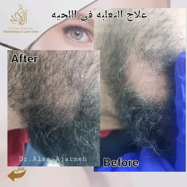 عيادة الدكتورة الاء العجارمة اختصاصية الامراض الجلدية