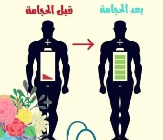 اخصائي مساج وحجامة 11