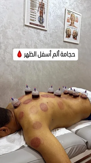 اخصائي مساج وحجامة 2