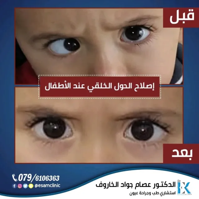 عيادة د.عصام الخاروف لطب وجراحة العيون 8