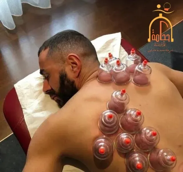شرطةِ محجم للتداوي 13