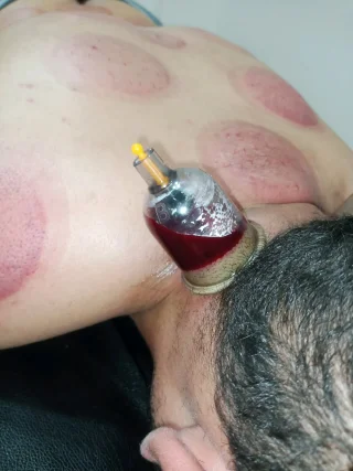 حجامة بأنواعها كايروبرايتيك شياتسو مصل النحل رقية شرعية 11