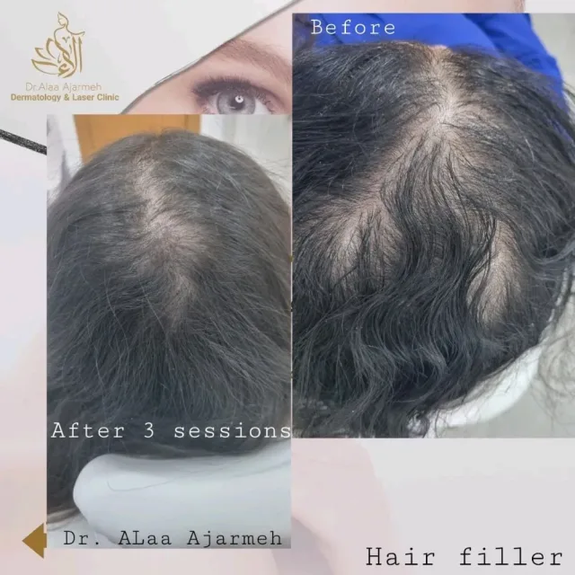 عيادة الدكتورة الاء العجارمة اختصاصية الامراض الجلدية