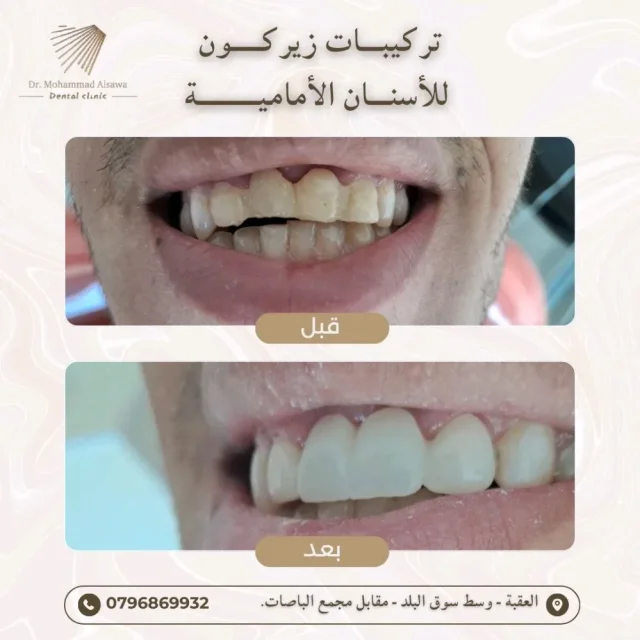 عيادة الدكتور محمد صايل الصوا طب و جراحة الفم والاسنان 5