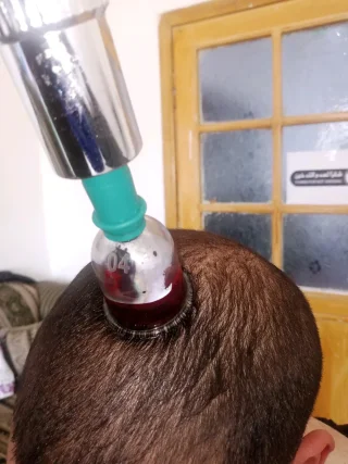 حجامة بأنواعها كايروبرايتيك شياتسو مصل النحل رقية شرعية 13