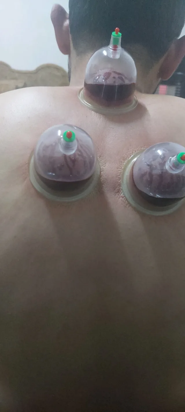 الرفاعي للرقية الشرعية والحجامة 3