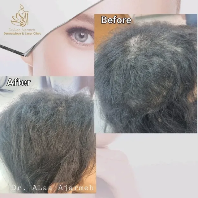 عيادة الدكتورة الاء العجارمة اختصاصية الامراض الجلدية
