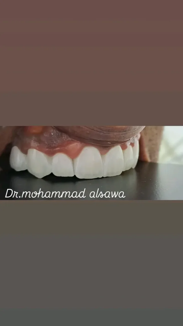 عيادة الدكتور محمد صايل الصوا طب و جراحة الفم والاسنان 11