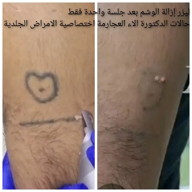 عيادة الدكتورة الاء العجارمة اختصاصية الامراض الجلدية