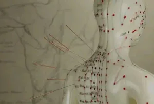 حجامة وزيوت وطب بديل ومساج علاجي 5