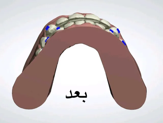 مختبر بيت المقدس لصناعة الأسنان 7