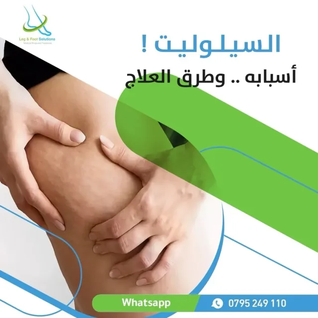 Leg and foot solutions