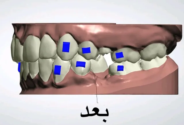 مختبر بيت المقدس لصناعة الأسنان 5