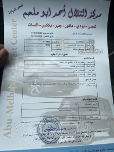هونداي XD بحاله جيده للبيع 11