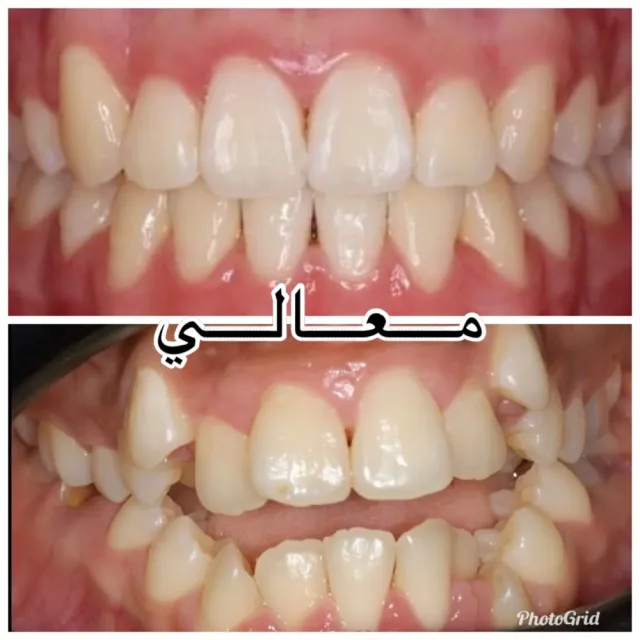 Maali Dental and orthodontic Center 6