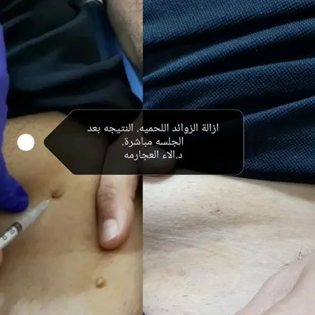 عيادة الدكتورة الاء العجارمة اختصاصية الامراض الجلدية
