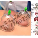 الحجامة العلمية النبوية