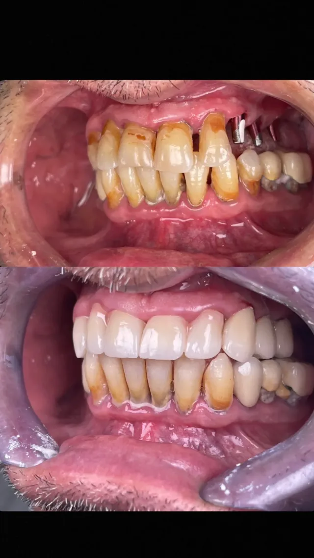 عيادة أسنان ، الدكتور نضال خليفة ، طبيب أسنان 2