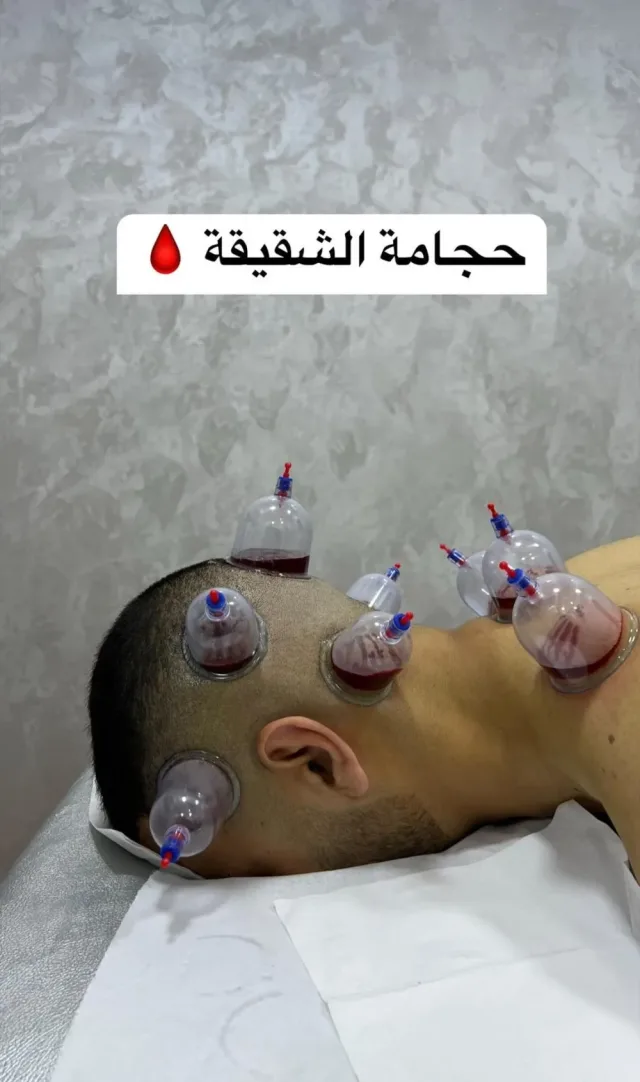 اخصائي مساج وحجامة 12