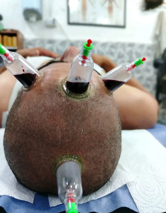 شرطةِ محجم للتداوي 7
