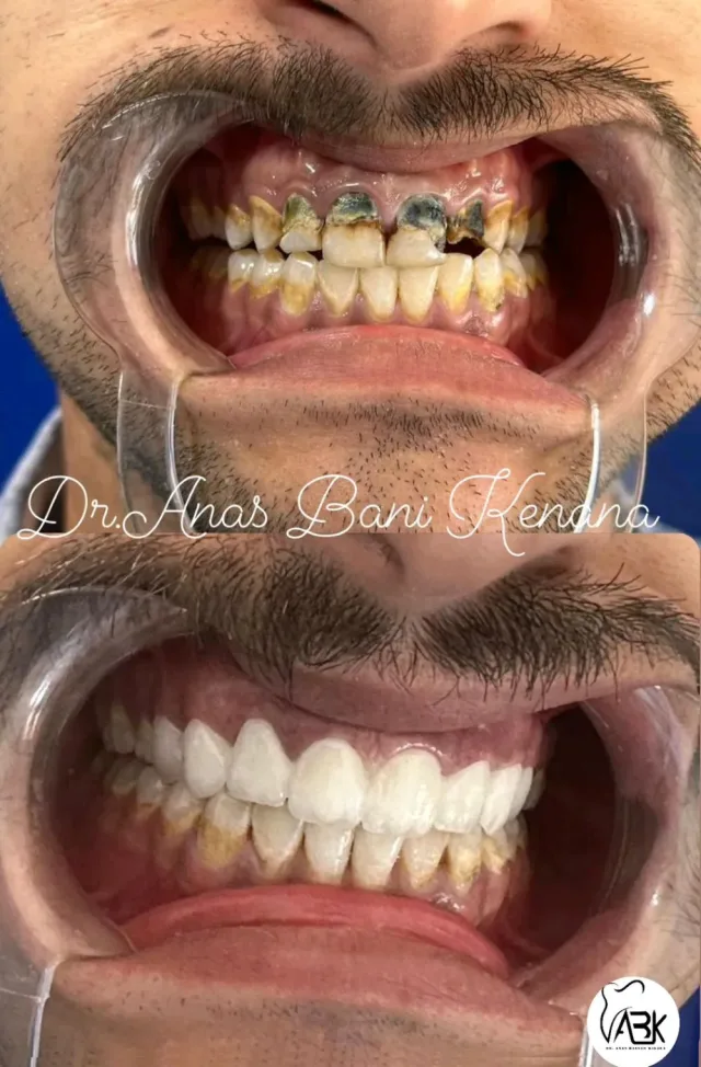 الدكتور أنس بسام بني كنانة (طبيب أسنان) 2