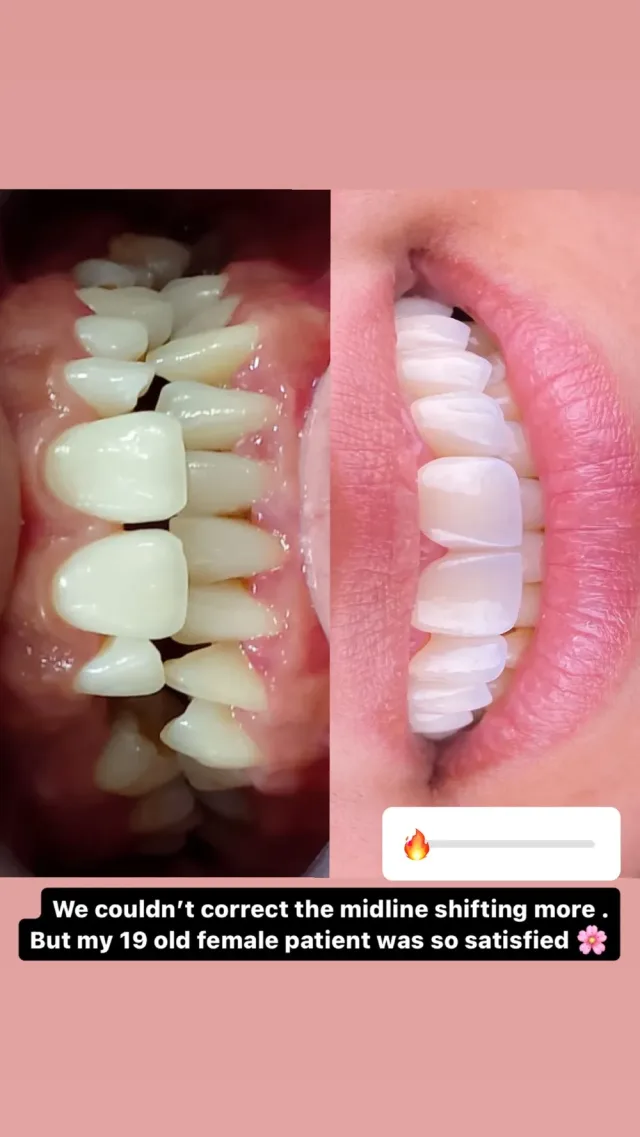 عيادة أسنان ، الدكتور نضال خليفة ، طبيب أسنان 6
