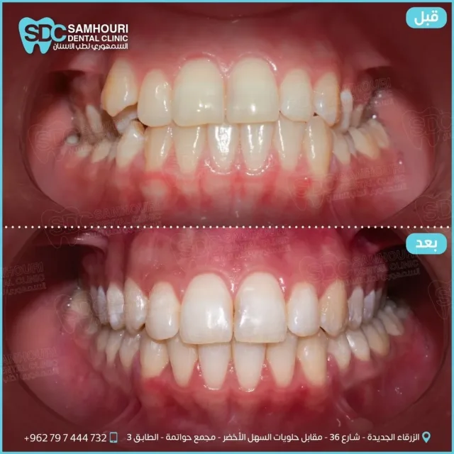 د.عبدالله السمهوري لطب وتقويم الأسنان 6