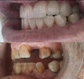 عيادة الدكتور محمد صايل الصوا طب و جراحة الفم والاسنان 7