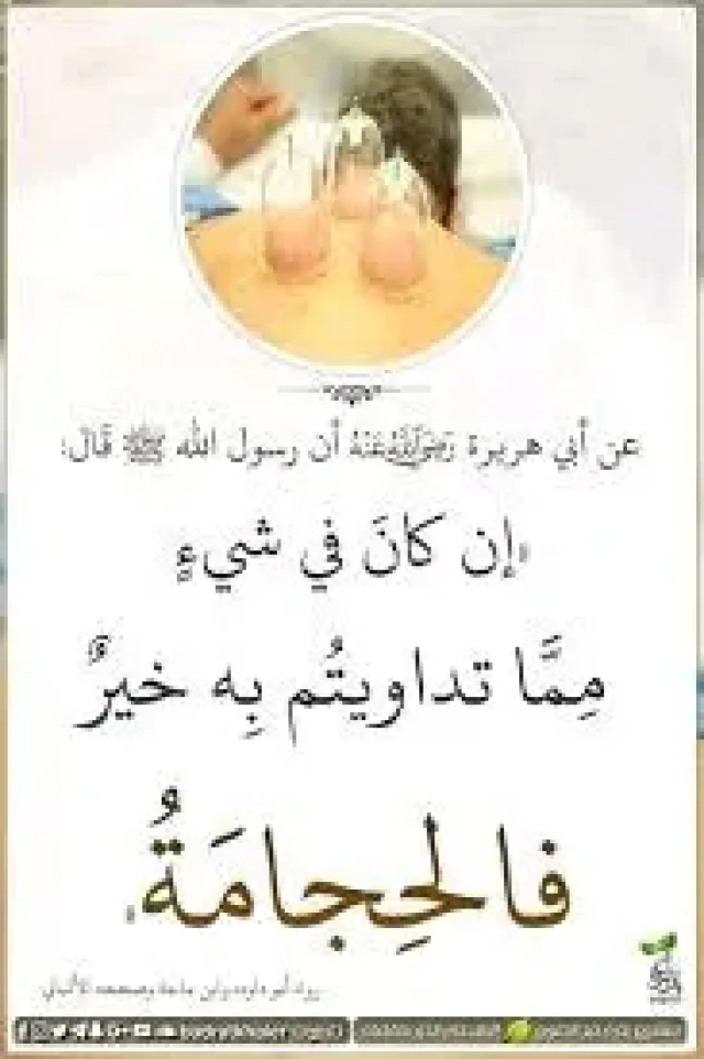 الحجامة النبوية و العلاجية 2
