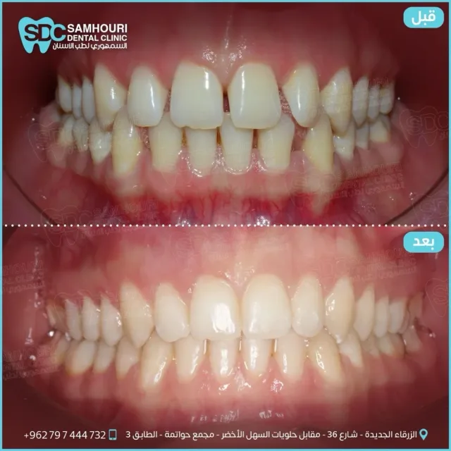 د.عبدالله السمهوري لطب وتقويم الأسنان 2
