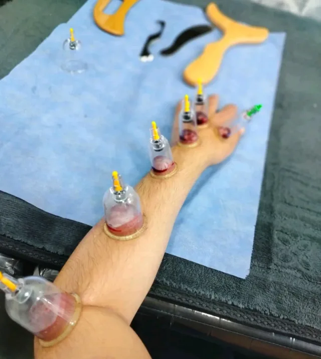 شرطةِ محجم للتداوي 14