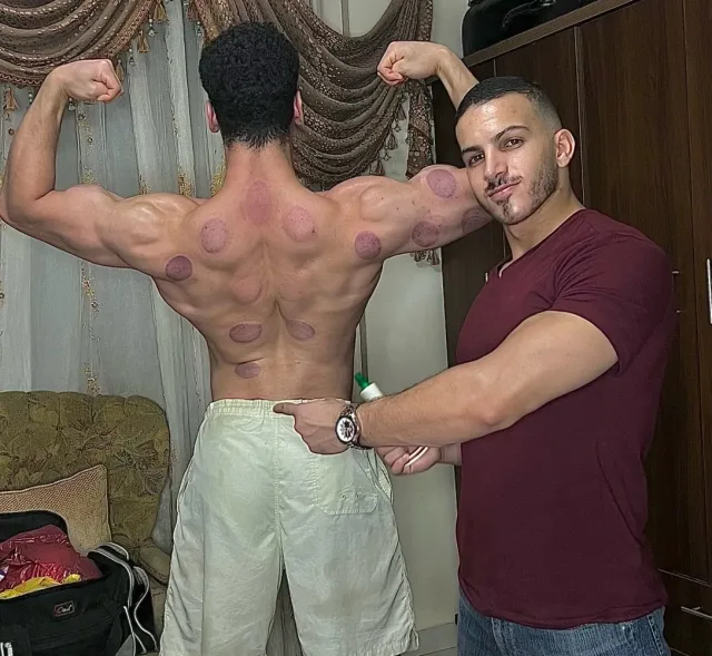 اخصائي مساج وحجامة 9