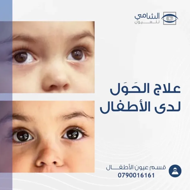 shami eye aqaba 4