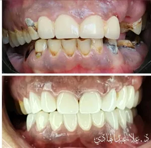 dr alaa abdulhadi dental clinic 2