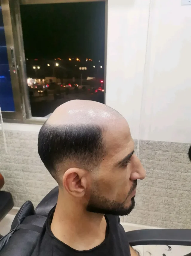 Dr. Hair 13