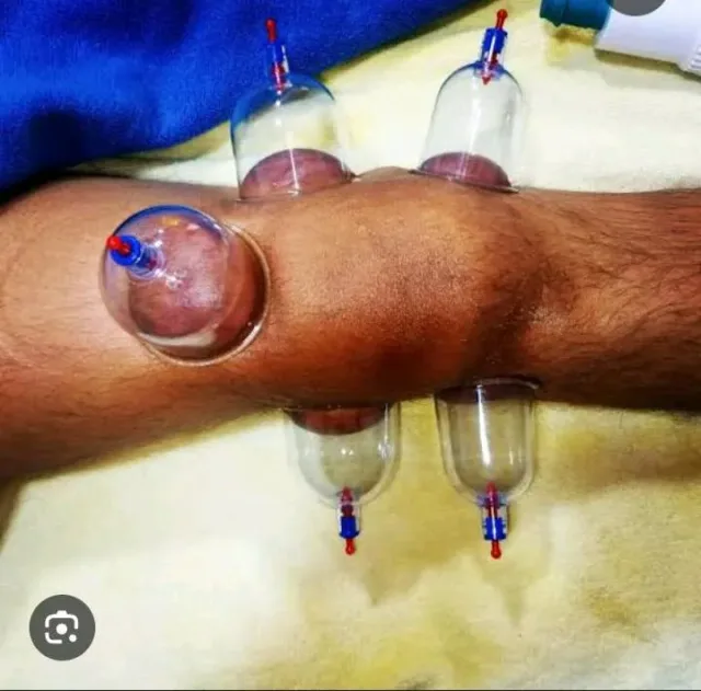 اخصائي مساج وحجامه 6