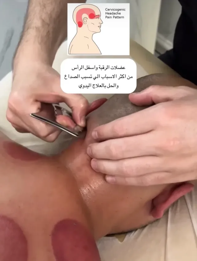 اخصائي مساج وحجامة 8